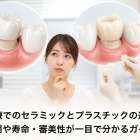歯科治療でのセラミックとプラスチックの違いは？費用や寿命・審美性が一目で分かるガイド